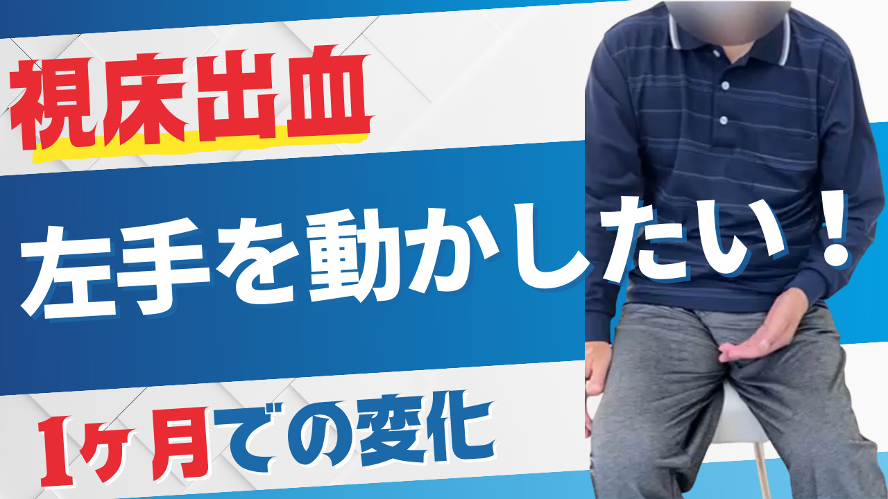 【視床出血】1ヶ月で麻痺の手を動かせるように【リハビリ】